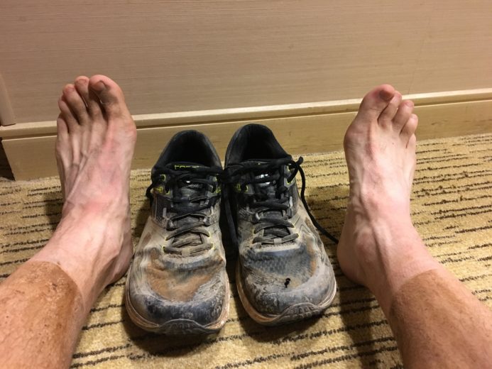 Post-Race Feet